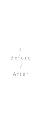 < Befor / After